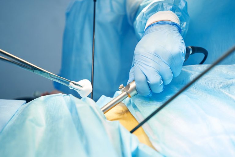 Why is Endoscopy Done? | Curasia Endoscopy Centre