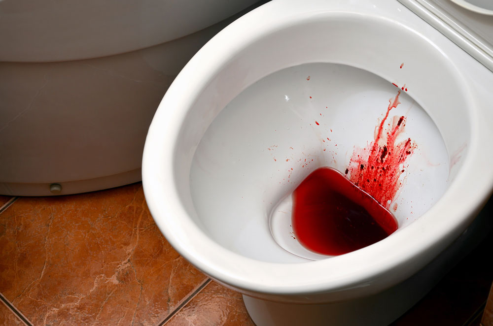 blood in the toilet bowl